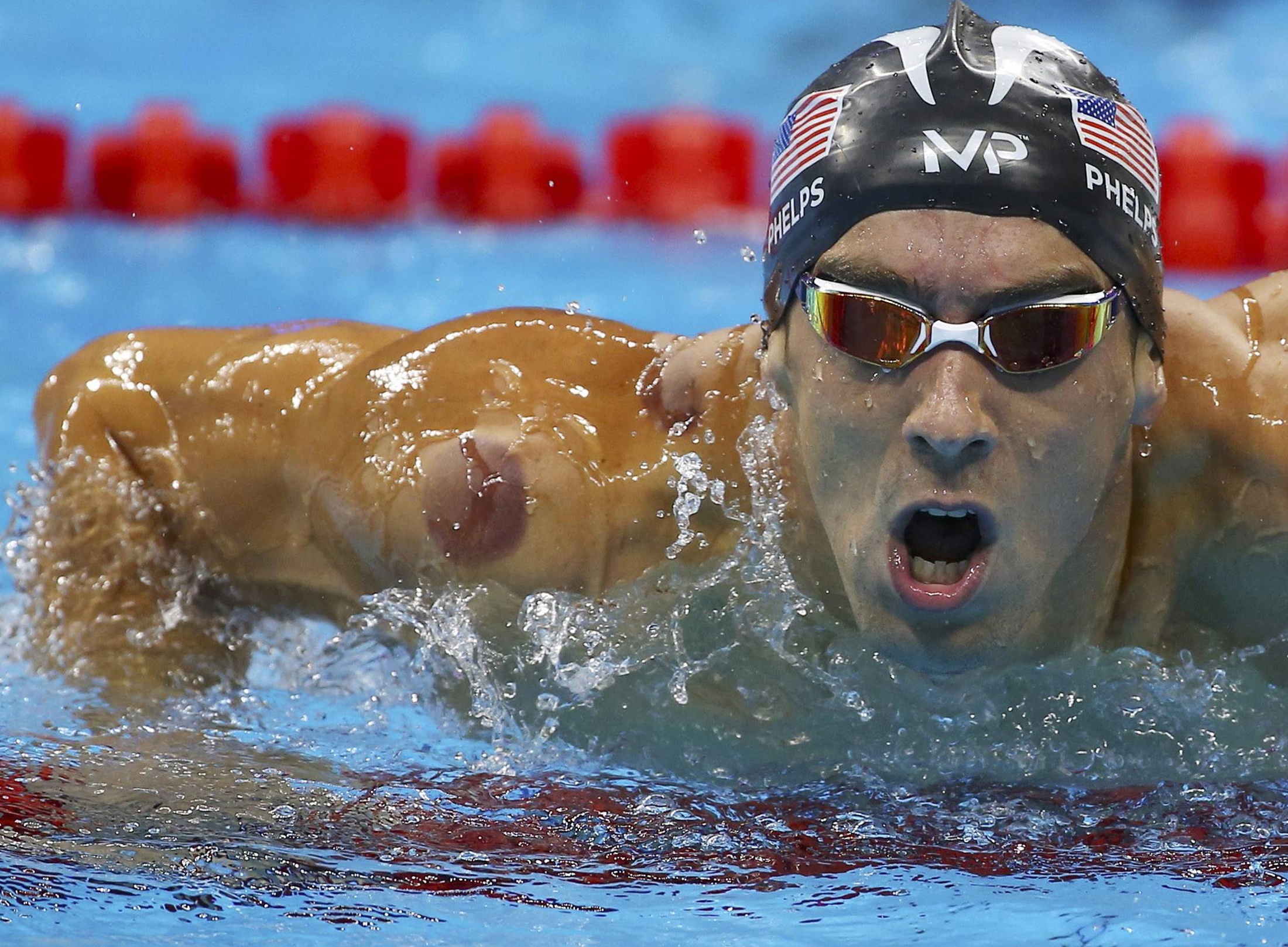 Michael Phelps & Cupping